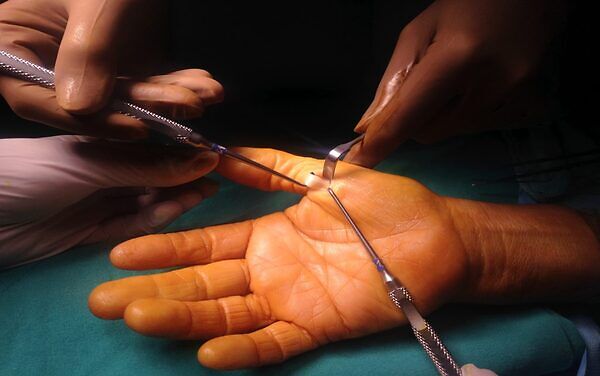 Kadavra Fleksör Tendon Onarım Modelinde Yeni Bir Mesh Sütürün Biyomekanik Özellikleri